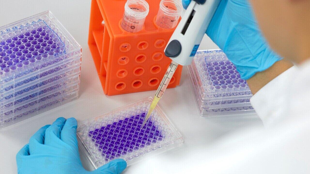 Tests within the scope of validation of cleaning of medical devices and materials